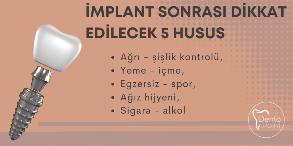 İmplant Diş Takıldıktan Sonra Dikkat Edilecek 5 Husus