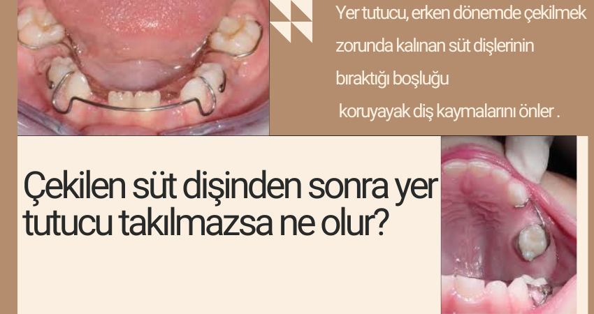 Çekilen süt dişinden sonra yer tutucu takılmazsa ne olur? İzmir